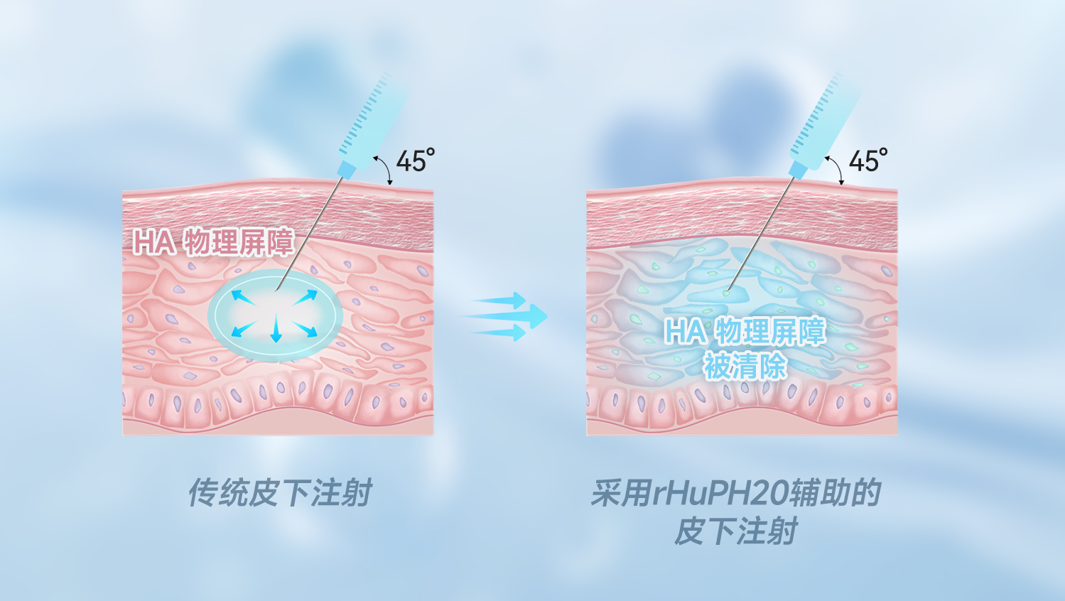 概述